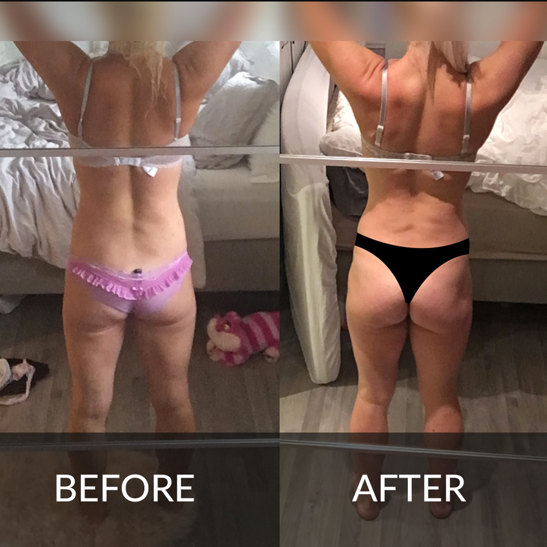 Butt lift from diet and exercise